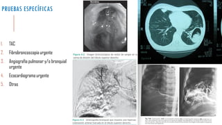 PRUEBAS ESPECÍFICAS 
1.TAC 
2.Fibrobroncoscopia urgente 
3.Angiografía pulmonar y/o bronquial urgente 
4.Ecocardiograma urgente 
5.Otras  