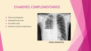 EXAMENES COMPLEMENTARIOS
 Electrocardiograma
 Radiografía de tórax
 Eco-doler color
 Examen funcional respiratorio
DISNEA PROGRESIVA
 