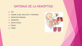 SINTOMAS DE LA HEMOPTISIS
 TOS
 SANGRE CLARA, BRILLANTE Y ESPUMOSA
 IRRITACION FARINGEA
 GORGOTEO
 DOLOR COSTAL
 DISNEA
 FIEBRE
 