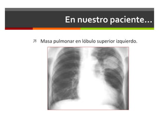 En nuestro paciente…
 Masa pulmonar en lóbulo superior izquierdo.
 