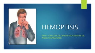 HEMOPTISIS
EXPECTORACIÓN DE SANGRE PROVENIENTE DEL
ÁRBOL RESPIRATORIO.
 