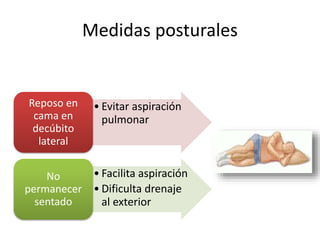 Medidas posturales
• Evitar aspiración
pulmonar
Reposo en
cama en
decúbito
lateral
• Facilita aspiración
• Dificulta drenaje
al exterior
No
permanecer
sentado
 
