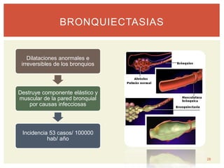 BRONQUIECTASIAS
Dilataciones anormales e
irreversibles de los bronquios
Destruye componente elástico y
muscular de la pared bronquial
por causas infecciosas
Incidencia 53 casos/ 100000
hab/ año
28
 