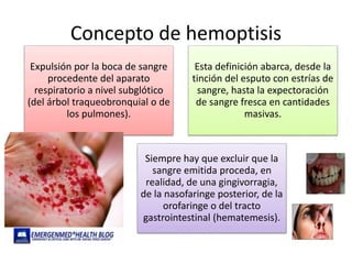 Concepto de hemoptisis
Expulsión por la boca de sangre
procedente del aparato
respiratorio a nivel subglótico
(del árbol traqueobronquial o de
los pulmones).
Esta definición abarca, desde la
tinción del esputo con estrías de
sangre, hasta la expectoración
de sangre fresca en cantidades
masivas.
Siempre hay que excluir que la
sangre emitida proceda, en
realidad, de una gingivorragia,
de la nasofaringe posterior, de la
orofaringe o del tracto
gastrointestinal (hematemesis).
 