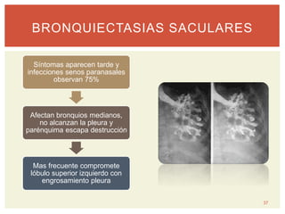 37
BRONQUIECTASIAS SACULARES
Síntomas aparecen tarde y
infecciones senos paranasales
observan 75%
Afectan bronquios medianos,
no alcanzan la pleura y
parénquima escapa destrucción
Mas frecuente compromete
lóbulo superior izquierdo con
engrosamiento pleura
 