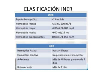CLASIFICACIÓN INER
 