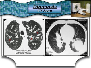DiagnosisDiagnosis
CT ScanCT Scan
 