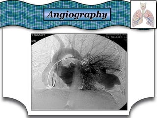 AngiographyAngiography
 