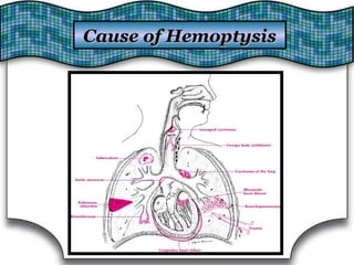 Cause of HemoptysisCause of Hemoptysis
 