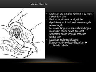 Manual Plasenta
• Dilakukan bila plasenta belum lahir 30 menit
setelah bayi lahir
• Berikan sedativa dan analgetik jika
diperlukan (untuk relaksasi dan mencegah
refleks vagal)
• Masukkan tangan secara obstetrik dengan
menelusuri bagian bawah tali pusat,
sementara tangan yang lain menahan
fundus uteri
• Lepaskan implantasi plasenta
Jika plasenta tidak dapat dilepaskan 
plasenta akreta
 