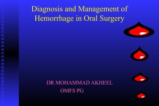 Diagnosis and Management of
 Hemorrhage in Oral Surgery




    DR MOHAMMAD AKHEEL
        OMFS PG
 