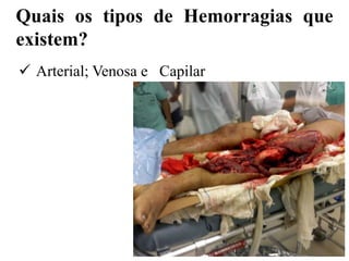 Quais os tipos de Hemorragias que
existem?
 Arterial; Venosa e Capilar
 