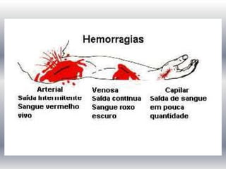 Hemorragia