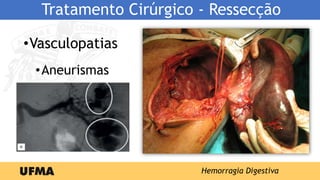 Tratamento Cirúrgico - Ressecção
•Vasculopatias
•Aneurismas
Hemorragia Digestiva
 