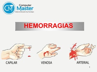 HEMORRAGIAS
1
 