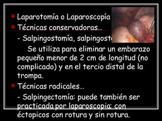<ul><li>Laparotomía o Laparoscopía </li></ul><ul><li>Técnicas conservadoras… </li></ul><ul><li>- Salpingostomía, salpingos...