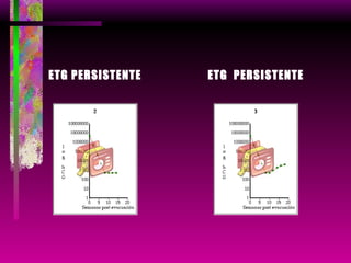 ETG PERSISTENTE ETG  PERSISTENTE 