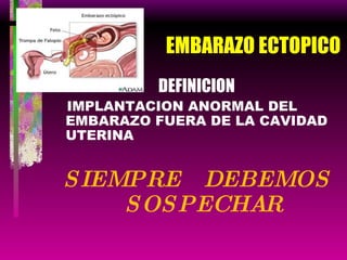 EMBARAZO ECTOPICO DEFINICION IMPLANTACION ANORMAL DEL EMBARAZO FUERA DE LA CAVIDAD UTERINA SIEMPRE  DEBEMOS SOSPECHAR 