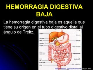 HEMORRAGIA DIGESTIVA BAJA La hemorragia digestiva baja es aquella que tiene su origen en el tubo digestivo distal al ángulo de Treitz.  Medicina Interna. Farreras Rozman 14º  Edicion. 2000 