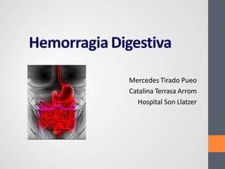 HemorragiaDigestiva
Mercedes Tirado Pueo
Catalina Terrasa Arrom
Hospital Son Llatzer
 