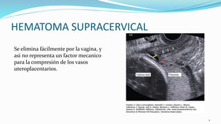 HEMATOMA SUPRACERVICAL
Se elimina fácilmente por la vagina, y
asi no representa un factor mecanico
para la compresión de los vasos
uteroplacentarios.
4
 