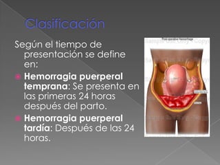 Clasificación<br />Según el tiempo de presentación se define en:<br />Hemorragia puerperal temprana: Se presenta en las pr...