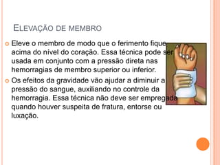 ELEVAÇÃO DE MEMBRO
 Eleve o membro de modo que o ferimento fique
acima do nível do coração. Essa técnica pode ser
usada em conjunto com a pressão direta nas
hemorragias de membro superior ou inferior.
 Os efeitos da gravidade vão ajudar a diminuir a
pressão do sangue, auxiliando no controle da
hemorragia. Essa técnica não deve ser empregada
quando houver suspeita de fratura, entorse ou
luxação.
 