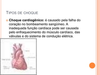 TIPOS DE CHOQUE
 Choque cardiogênico: é causado pela falha do
coração no bombeamento sangüíneo. A
inadequada função cardíaca pode ser causada
pelo enfraquecimento do músculo cardíaco, das
válvulas e do sistema de condução elétrica.
 