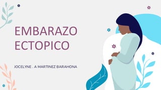 EMBARAZO
ECTOPICO
JOCELYNE . A MARTINEZ BARAHONA
 