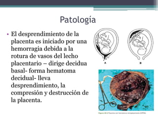 Patología
• El desprendimiento de la
placenta es iniciado por una
hemorragia debida a la
rotura de vasos del lecho
placent...
