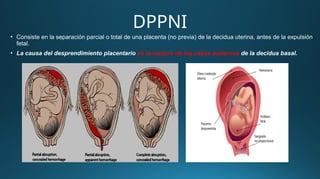 DPPNI
• Consiste en la separación parcial o total de una placenta (no previa) de la decidua uterina, antes de la expulsión
fetal.
• La causa del desprendimiento placentario es la ruptura de los vasos maternos de la decidua basal.
 