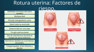 Rotura uterina: Factores de
riesgo.
Debilidad intrínseca del útero
(didelfo)
Multiparidad
Periodo intergenésico corto
Edad materna avanzada
Histerorrafia en una capa
Cirugía uterina previa
Uso de uterotónicos durante el
trabajo de parto (oxitocina
Maniobras obstétricas traumáticas
(Kristeller)
Colagenopatías: Erlen Dharlos y
Marfán
 