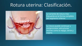 Rotura uterina: Clasificación.
La variante de rotura mas
frecuente es la forma completa
del segmento inferior.
La rotura puede continuar y
comprometer estructuras
vecinas como la vejiga, cervix y
vagina.
 