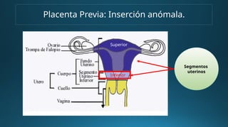 Placenta Previa: Inserción anómala.
Segmentos
uterinos
Superior
Inferior
 