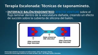 • INTERFACE BALÓN/ENDOMETRIO: EFECTO VENTURI sobre el
flujo laminar dentro de la vasculatura dañada, creando un efecto
de succión sobre la cubierta de silicona del balón.
Hemorragia obstétrica manejada con balón de Bakri. 2016. VM Vargas. Elsevier.
Control de la hemorragia obstétrica con balón de Bakri. 2013. VM Ortega Castillo. Ginecobst.
Terapia Escalonada: Técnicas de taponamineto.
 