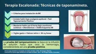 La prueba del tamponamiento se basa en la infusión
de solución hasta que cesa la hemorragia,
considerándola así una prueba positiva.
Hemorragia obstétrica manejada con balón de Bakri. 2016. VM Vargas. Elsevier.
Control de la hemorragia obstétrica con balón de Bakri. 2013. VM Ortega Castillo. Ginecobst.
Terapia Escalonada: Técnicas de taponamineto.
 