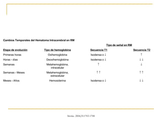       Isodensa o     Hemosiderina Meses - Años             Metahemoglobina, extracelular Semanas - Meses       Metahemoglobina, intracelular Semanas       Isodensa o     Deoxihemoglobina Horas - días    Isodensa o     Oxihemoglobina Primeras horas Secuencia T2 Secuencia T1 Tipo de hemoglobina Etapa de evolución Tipo de señal en RM   Cambios Temporales del Hematoma Intracerebral en RM 