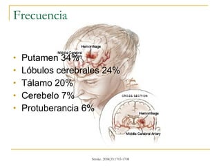 Frecuencia Putamen 34% Lóbulos cerebrales 24% Tálamo 20% Cerebelo 7% Protuberancia 6% 