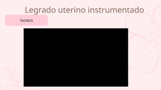 Legrado uterino instrumentado
TECNICA
 