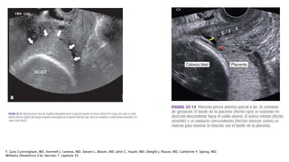 F. Gary Cunningham, MD. Kenneth J. Leveno, MD. Steven L. Bloom, MD. John C. Hauth, MD. Dwight J. Rouse, MD. Catherine Y. Spong, MD.
Williams Obstetricia 23e, Sección 7. capítulo 35
 