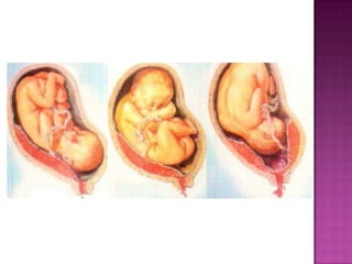  Repeticion y acentuacion del embarazo
 Roptura prematura de membranas
 Interrupcion prematura del embarazo
 
