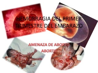 HEMORRAGIA DEL PRIMER
TRIMESTRE DEL EMBARAZO
 