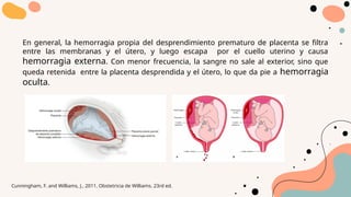 En general, la hemorragia propia del desprendimiento prematuro de placenta se filtra
entre las membranas y el útero, y luego escapa por el cuello uterino y causa
hemorragia externa. Con menor frecuencia, la sangre no sale al exterior, sino que
queda retenida entre la placenta desprendida y el útero, lo que da pie a hemorragia
oculta.
Cunningham, F. and Williams, J., 2011. Obstetricia de Williams. 23rd ed.
 