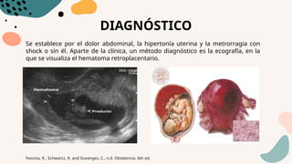 DIAGNÓSTICO
Se establece por el dolor abdominal, la hipertonía uterina y la metrorragia con
shock o sin él. Aparte de la clínica, un método diagnóstico es la ecografía, en la
que se visualiza el hematoma retroplacentario.
Fescina, R., Schwarcz, R. and Duverges, C., n.d. Obstetricia. 6th ed.
 