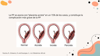 La PP se asocia con “placenta acreta” en un 15% de los casos, y constituye la
complicación más grave de la PP
Fescina, R., Schwarcz, R. and Duverges, C., n.d. Obstetricia. 6th ed.
 