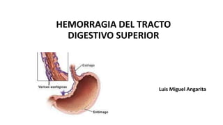 HEMORRAGIA DEL TRACTO
DIGESTIVO SUPERIOR
Luis Miguel Angarita
 