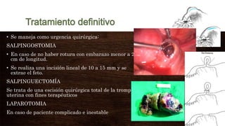• Se maneja como urgencia quirúrgica:
SALPINGOSTOMIA
• En caso de no haber rotura con embarazo menor a 2
cm de longitud.
• Se realiza una incisión lineal de 10 a 15 mm y se
extrae el feto.
SALPINGUECTOMÍA
Se trata de una escisión quirúrgica total de la trompa
uterina con fines terapéuticos
LAPAROTOMIA
En caso de paciente complicado e inestable
 
