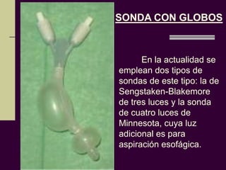 SONDA CON GLOBOS



      En la actualidad se
emplean dos tipos de
sondas de este tipo: la de
Sengstaken-Blakemore
de tres luces y la sonda
de cuatro luces de
Minnesota, cuya luz
adicional es para
aspiración esofágica.
 