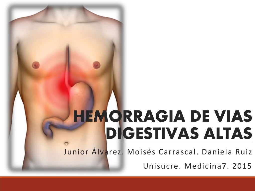 Hemorragia de Vías Digestivas Altas Hemorragia de Vías Digestivas Altas