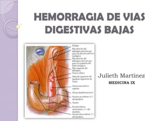 HEMORRAGIA DE VIAS
  DIGESTIVAS BAJAS



          Julieth Martínez
             MEDICINA IX
 